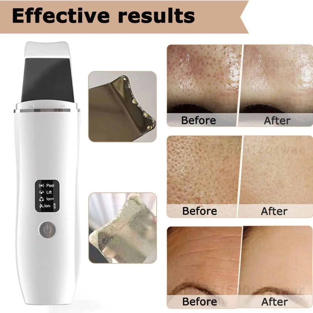 Reveal Cleaner Skin and Feel More Confident!
