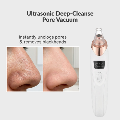 Pore Vacuum Blackhead Remover