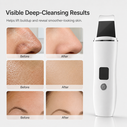 Ultrasonic Skin Scrubber